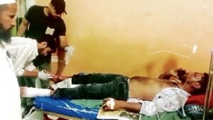 CG News: दुकान में फटा AC कंप्रेशर, ब्लास्ट की चपेट में आए दो सगे भाई, अस्पताल में भर्ती 