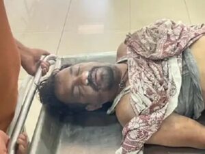 रायगढ़ में फटा AC, भीषण हादसे में पिता की मौत, पुत्र घायल, ITI कॉलोनी में देर रात हादसा, 2 बाइक जलकर खाक