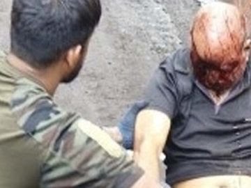 Raigarh News: हाइड्रा की टक्कर से HR हेड की मौत:परिसर में पैदल चलते समय पीछे से हाइड्रा ने मारी ठोकर, सिर पर आई चोटें