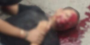 Raigarh News: रायगढ़ में खौफनाक सड़क हादसा, कबीर चौक-ओडिशा रोड पर बाइक और स्कूटी में आमने-सामने की जोरदार भिड़ंत,  3 लोग घायल, सिर और जबड़े में आई गहरी चोटें, डॉक्टर कर रहे इलाज