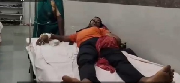 CG News: जहरीले सांप को गले में डालकर मस्ती करना पड़ा भारी, डसने के बाद युवक की बिगड़ी तबीयत, अस्पताल में भर्ती