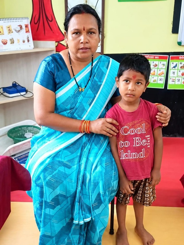 ​चिरायु से मिली नई उड़ान- नन्हें सूर्या के टेढ़े पैरों को मिली राह, अब आत्मविश्वास से दौड़ रहा 4 साल का मासूम